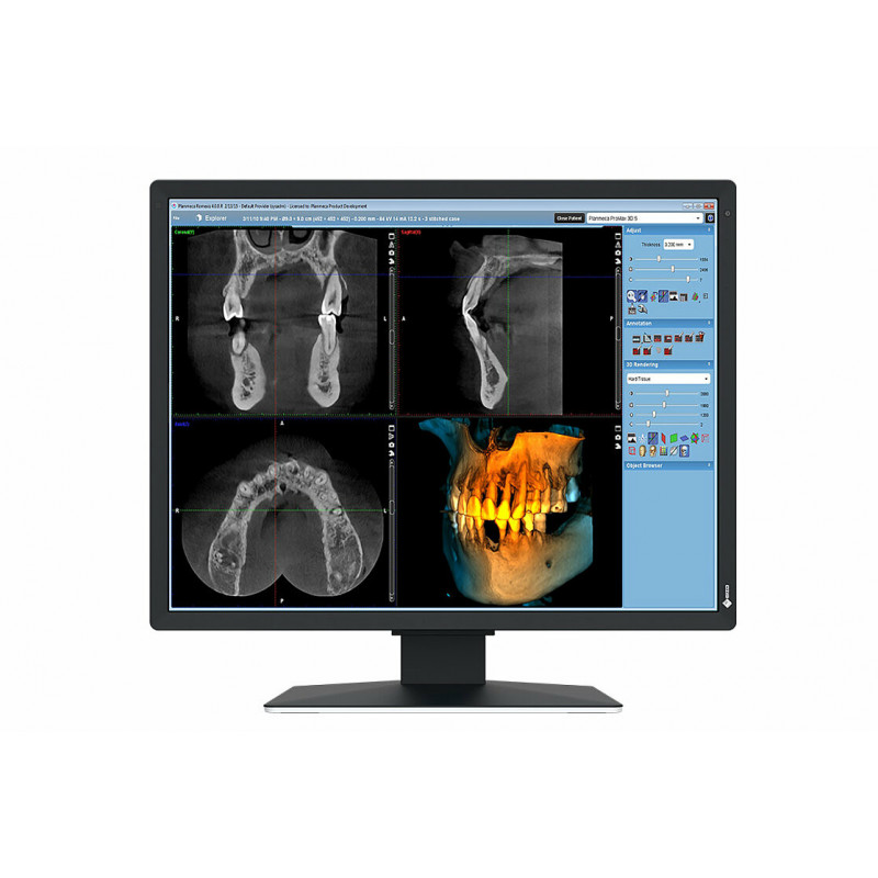 EIZO RadiForce MX217-SB tietokoneen litteä näyttö 53,3 cm (21") 1200 x 1600 pikseliä UXGA LCD Musta