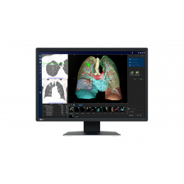 EIZO RadiForce MX243W tietokoneen litteä näyttö 61,2 cm (24.1") 1920 x 1200 pikseliä WUXGA LCD Musta
