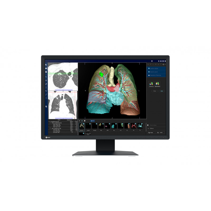 EIZO RadiForce MX243W tietokoneen litteä näyttö 61,2 cm (24.1") 1920 x 1200 pikseliä WUXGA LCD Musta