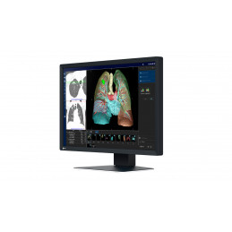 EIZO RadiForce MX243W tietokoneen litteä näyttö 61,2 cm (24.1") 1920 x 1200 pikseliä WUXGA LCD Musta