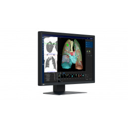 EIZO RadiForce MX243W tietokoneen litteä näyttö 61,2 cm (24.1") 1920 x 1200 pikseliä WUXGA LCD Musta